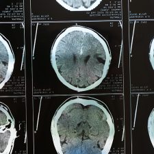 Brain scans